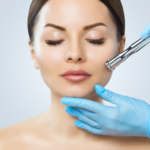 PRP Facial/Facelift with Microneedling